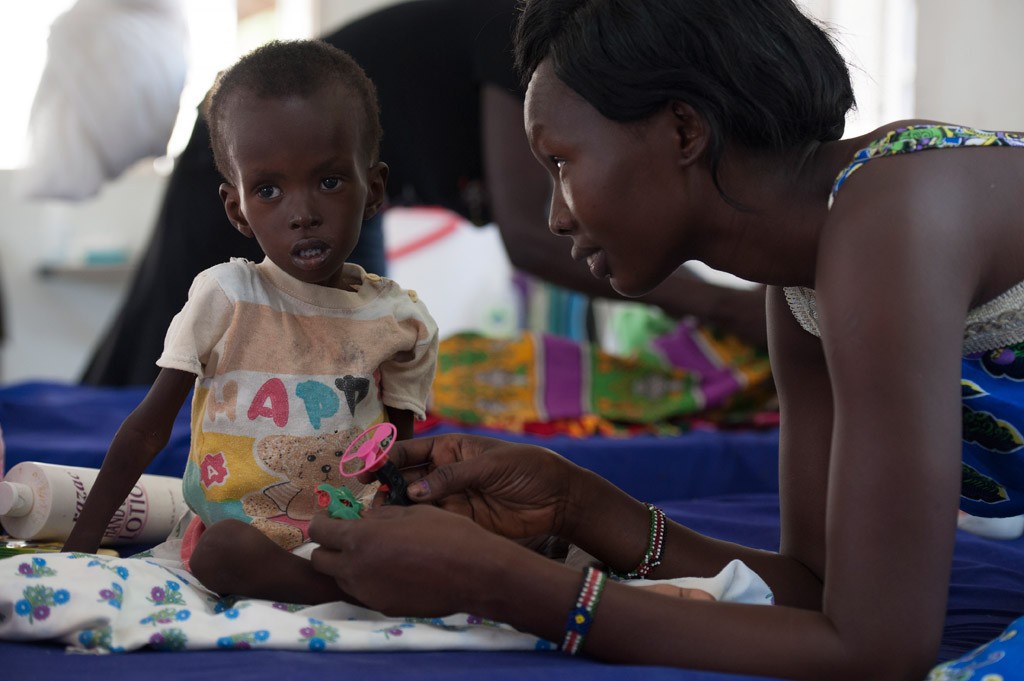 Kuot, de dois anos de idade, sendo tratado de desnutrição aguda grave no Hospital de Crianças de Al-Shabbah, apoiado pelo UNICEF, em Juba, Sudão do Sul. Foto: UNICEF/Sebastian Rich 